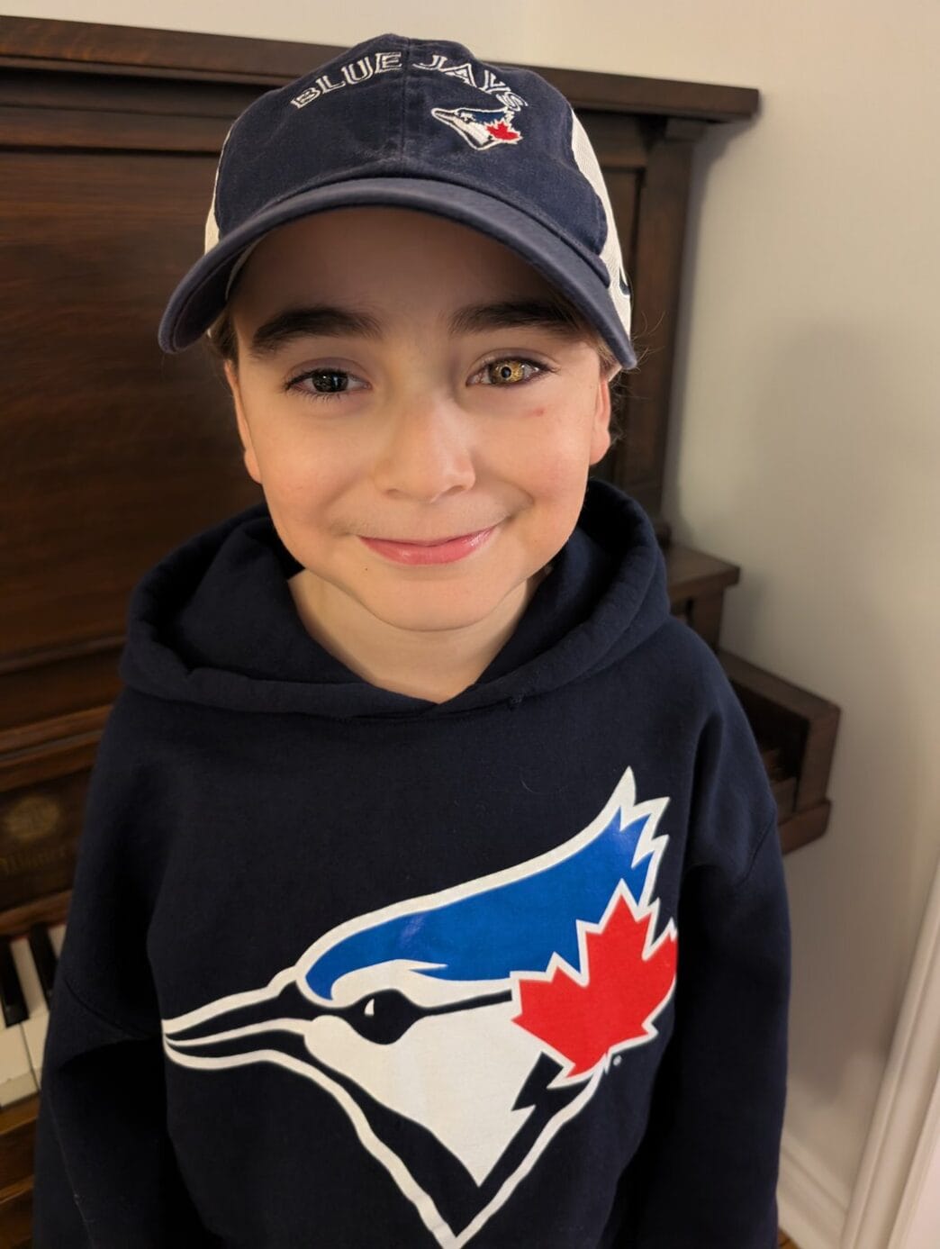 Aggregator Downloaded image for imported item 81042 | Meridian Source Eight-year-old shows his love for the Blue Jays with custom prosthetic eye