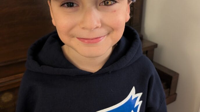 Aggregator Downloaded image for imported item 81042 | Meridian Source Eight-year-old shows his love for the Blue Jays with custom prosthetic eye