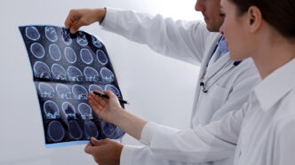 Doctors examining MRI images of patient with multiple sclerosis | Meridian Source