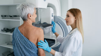 Senior woman having mammography scan at hospital with medical technician Mammography procedure breast cancer prevention | Meridian Source